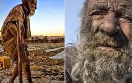 Vì sao "người đàn ông bẩn nhất thế giới" lại qua đời ngay sau khi tắm lần đầu tiên?