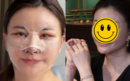 Nữ diễn viên Việt vừa phẫu thuật thẩm mỹ mặt ở Hàn Quốc bị chê mạnh, phải vội lên tiếng làm rõ 1 thông tin