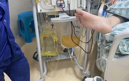 Chàng trai 19 tuổi máu đục như sữa, suy đa tạng nguy kịch vì 2 kiểu LƯỜI người trẻ thường mắc phải