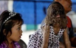 Cô bé “người sói” hiện ra sao?