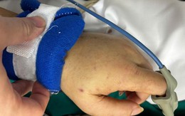 Bệnh viện Bạch Mai phát cảnh báo về 1 căn bệnh nguy hiểm, lây lan nhanh, tỷ lệ tử vong cao