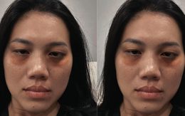 Dụi mắt không nhận ra Ánh Viên, sao lại ra nông nỗi này?