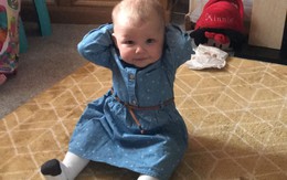 Nuốt viên pin cúc áo, bé gái 2 tuổi thủng động mạch chủ, chết thương tâm