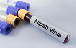 Vi rút Nipah nguy hiểm ra sao?