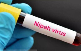 Virus Nipah lây qua đường nào?