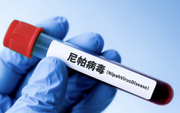 NÓNG: Các nhà khoa học Trung Quốc tìm ra thuốc kháng virus Nipah