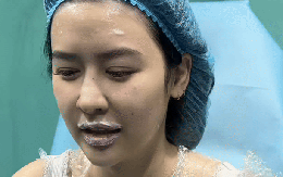 Quyên Qui tu sửa gương mặt