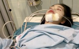 Ngày càng nhiều người chết vì ung thư vòm họng? Bác sĩ cảnh báo: Có 5 nhóm người bị liệt vào danh sách "RỦI RO CAO"