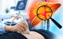 Chăm tập thể dục, kiêng chất béo nhưng gan vẫn nhiễm mỡ: Bác sĩ Bạch Mai chỉ ra nguyên nhân
