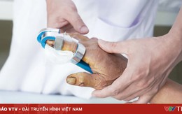 Bỏng nặng do điện thoại phát nổ khi đang sạc