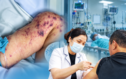 Căn bệnh truyền nhiễm diễn biến tối cấp, đe dọa tính mạng chỉ trong vài giờ: Ghi nhận ổ dịch tại TP.HCM