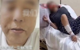 Người đàn ông bị chó cắn 47 ngày rồi qua đời: Bác sĩ nhắc điều phải làm ngay khi có vết thương