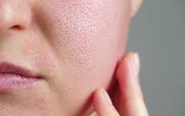 2 loại nước vạn người mê đang cướp đi vẻ rạng rỡ, gây nếp nhăn sâu nhưng rất nhiều chị em không biết