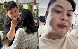 Cô dâu bị ong đốt, thợ make up đến “cứu” cũng bị đốt sưng môi: Người trong cuộc kể chuyện hy hữu