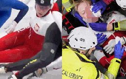 Kinh hoàng Olympic: VĐV bị giày của đối thủ cứa vào mắt, buộc nằm cáng rời sân