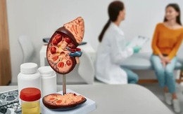 4 loại thực phẩm “bức tử” thận mỗi ngày: Không ít người vẫn vô tư dùng