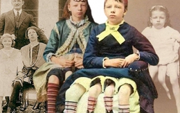 Cô gái 4 chân, 2 "vùng kín": 13 tuổi thành đại minh tinh với cuộc hôn nhân bí ẩn