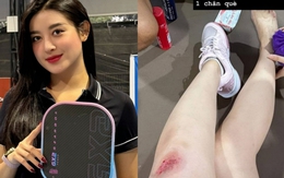 Á hậu Huyền My gặp tai nạn khi chơi pickleball