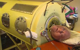 Người đàn ông sống cả đời 70 năm trong một chiếc lồng sắt