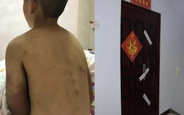 Bi kịch của cậu bé 14 tuổi vẫn phải mặc tã