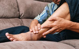 Thấy 6 dấu hiệu này xuất hiện trên tay, chân vào buổi tối, cẩn thận kẻo đột quỵ đã “gõ cửa”