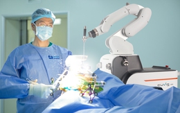 Việt Nam lần đầu có robot AI “tự mổ”: Chính xác đến từng milimet, thế giới mới có 9 nước sở hữu