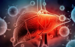 Thói quen biến “thuốc bổ” thành “chất độc” với lá gan của nhiều người Việt: Bác sĩ cảnh báo khẩn