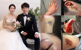 Anh trai Jisoo (BLACKPINK) lại trở thành tâm điểm phẫn nộ: Bị tố bạo hành gia đình, bắt vợ phải quỳ gối xin tha?