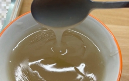 Thiếu nữ 16 tuổi qua đời vì suy thận, người mẹ tiết lộ bí mật liên quan đến điều gần như cô gái nào cũng "ám ảnh"