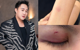 Mới nhất drama hành hung nữ bác sĩ: Trung Quân thông báo ngưng hoạt động rồi xoá post sau 10 phút