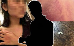 Sao nam ra tay hành hung phụ nữ bị tạm giam 30 ngày sau khi trình diện cảnh sát, các ông bầu hủy show hàng loạt