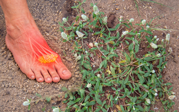 Nghiên cứu gây chú ý của Việt Nam: Một loài cây dại có thể ức chế enzyme gây bệnh gút