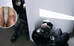 Nữ ca sĩ yêu lại bạn trai cũ từng đánh cô bầm dập toàn thân: “Tôi không kiện anh ấy nữa”