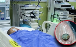 Bé trai 3 tuổi nuốt phải pin cúc áo, mẹ cho uống ngay 1 thìa gia vị, đến bệnh viện bác sĩ khen: "Giỏi lắm"