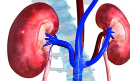 Bác sĩ tiết niệu cảnh báo: Nhiều quả thận bị hỏng “oan uổng” chỉ vì những sai lầm rất phổ biến