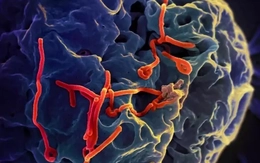 Dịch Ebola diễn biến phức tạp, Bộ Y tế họp khẩn
