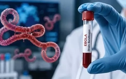 Bộ Y tế kích hoạt giám sát dich Ebola, tăng cường ngăn dịch xâm nhập