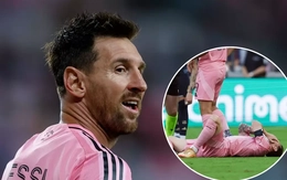 HLV Argentina báo tin về chấn thương của Messi