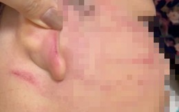 Vụ thầy giáo Ấn Độ tát học sinh lớp 4: Dừng hoạt động lớp dạy thêm