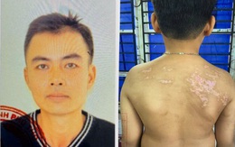 Thi hành Lệnh bắt tạm giam Nguyễn Hà Chung, nạn nhân là con ruột mới hơn 7 tuổi