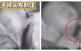Bé trai 2 tuổi suýt chết vì bị tóc dài của mẹ thắt cổ trong lúc ngủ