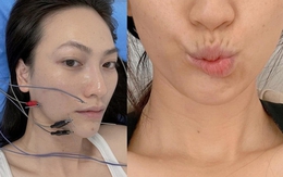 Nữ chính phim trăm tỷ của Trấn Thành: Từng đi bán xôi lề đường, bị biến chứng sau ca mổ tuyến giáp