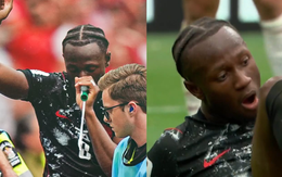 Ngôi sao Canada gãy chân rùng rợn ở World Cup hít cái gì màu xanh?
