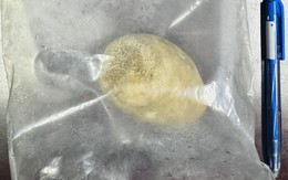 Món quà "độc nhất vô nhị" của bệnh nhân sau ca mổ: Lời cảnh báo về 1 kiểu uống nước của nhiều người Việt