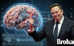 Elon Musk và hành trình gắn chip vào não người: Tư tưởng của thế hệ đàn ông bản lĩnh không đầu hàng trước lão hóa, bệnh tật