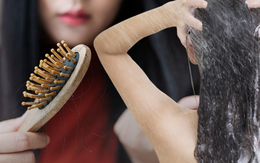 Gội đầu kiểu này cực hại da đầu lại dễ gây hói: Đáng tiếc nhiều người Việt vẫn mắc, thay đổi ngay hôm nay để cứu lấy mái tóc