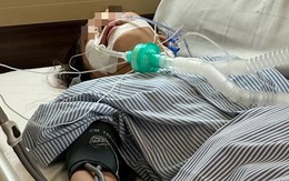 Trung Quốc: Cô gái 24 tuổi sốc phản vệ, rơi vào nguy kịch vì uống 10ml nước dừa giải nhiệt
