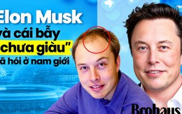 Chưa kịp giàu đã hói: Nghi vấn từ mái tóc hồi sinh của Elon Musk và cái bẫy "cày cuốc" bóp nghẹt phong độ đàn ông