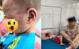 Đi làm về thấy chồng xin lỗi, vợ chết lặng khi nhìn vào mặt con, lập tức báo công an