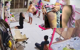 Bố ruột bé gái 11 tuổi bị người tình của mẹ bạo hành xót xa: “Tôi cứ nghĩ cháu đang hạnh phúc"